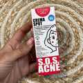 SOS acne